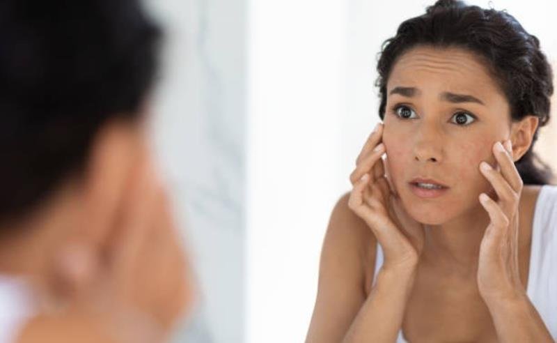 O rosto cansado virou uma das principais queixas femininas nos consultórios de estética — e o problema vai além da idade